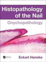 Histopathology of the Nail | Switzerland) Eckart (University of Berne Haneke